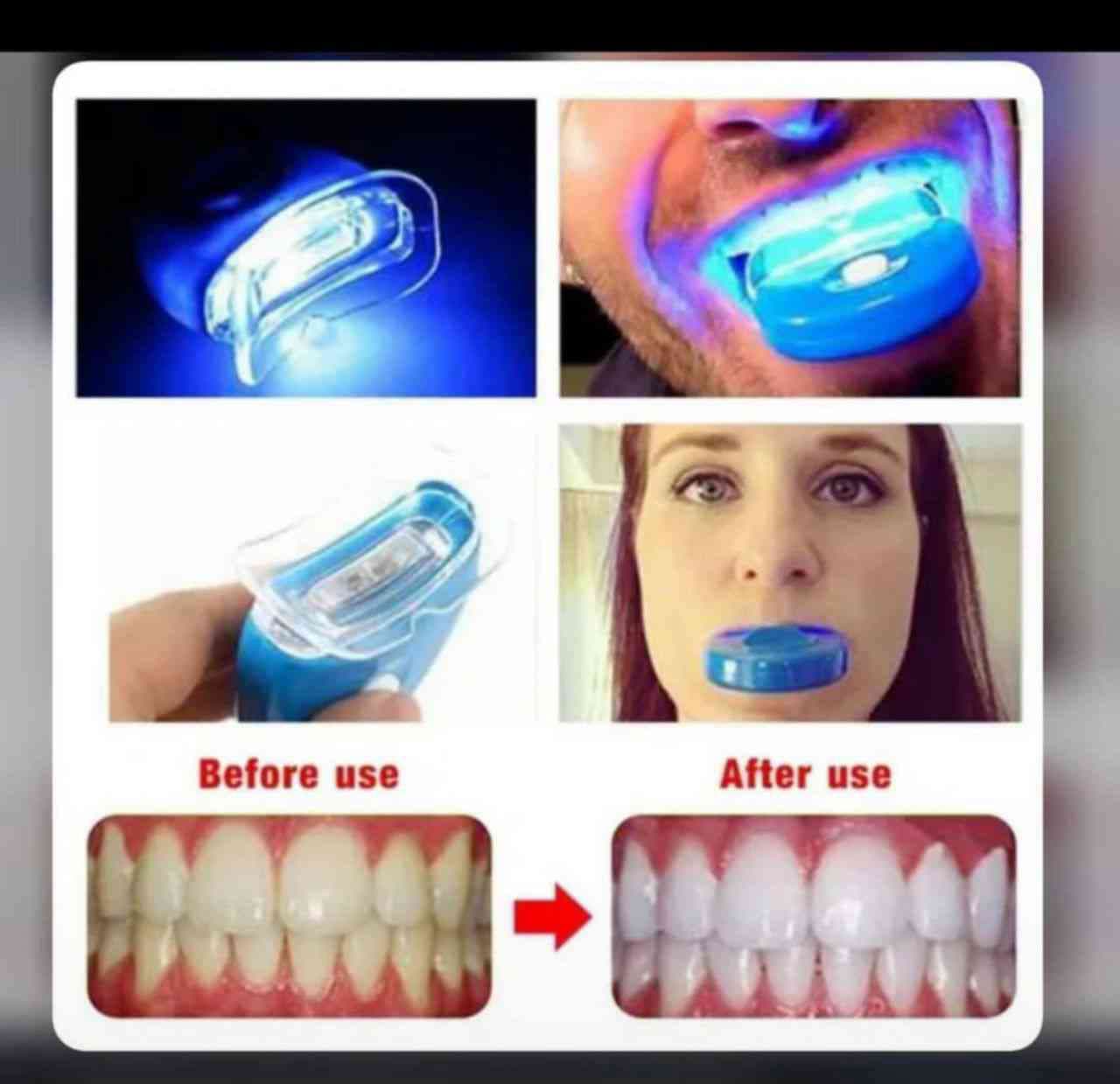 LED Teeth Whitening Machine, whitens teeth 